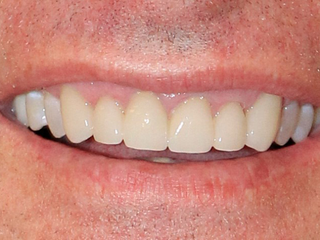 case-study-4-smile-4