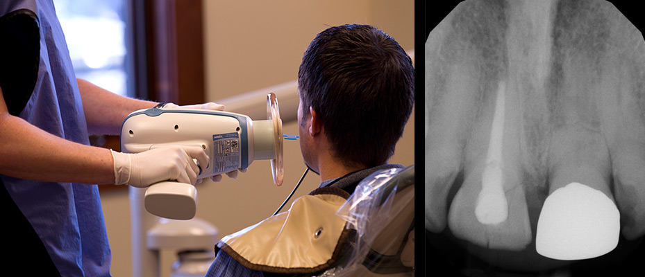 Digital Dental Radiographs